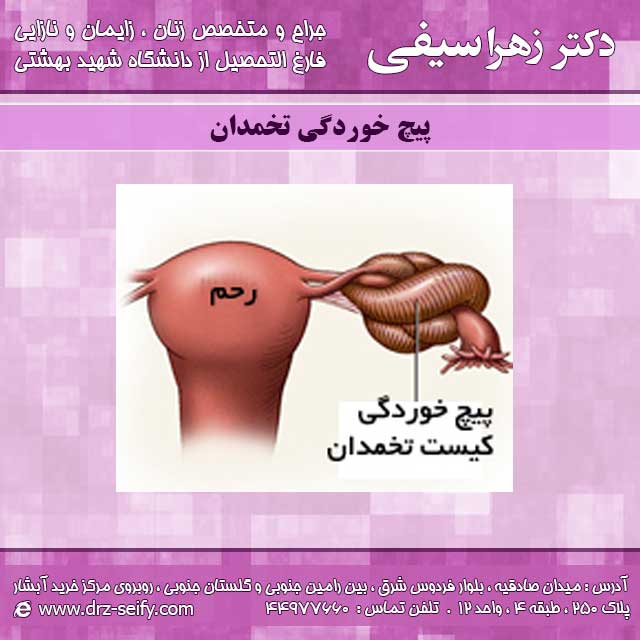 پیچ خوردگی تخمدان