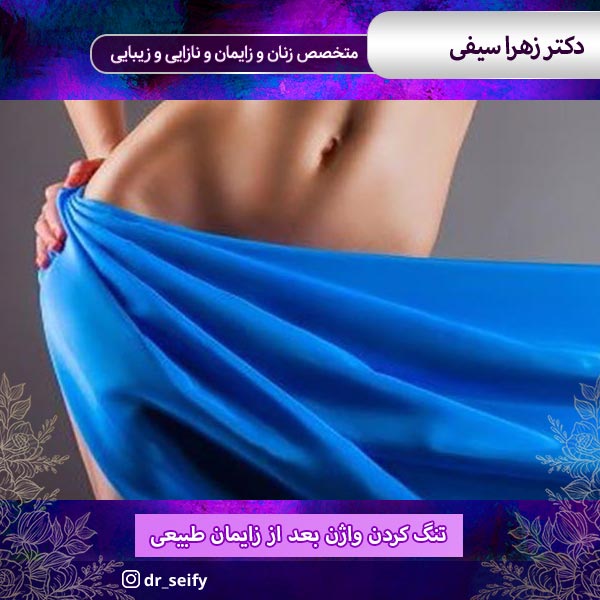 تنگ کردن واژن بعد از زایمان طبیعی