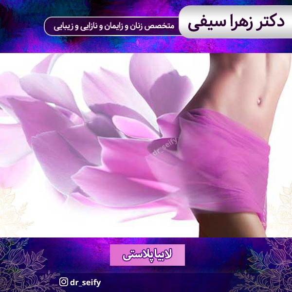 لابیاپلاستی در تهران