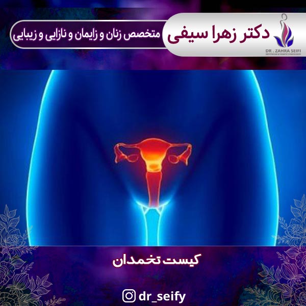 کیست تخمدان