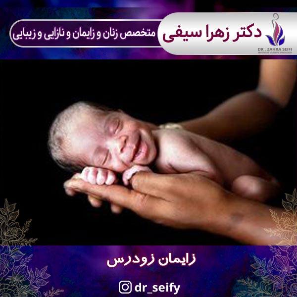 زایمان زودرس