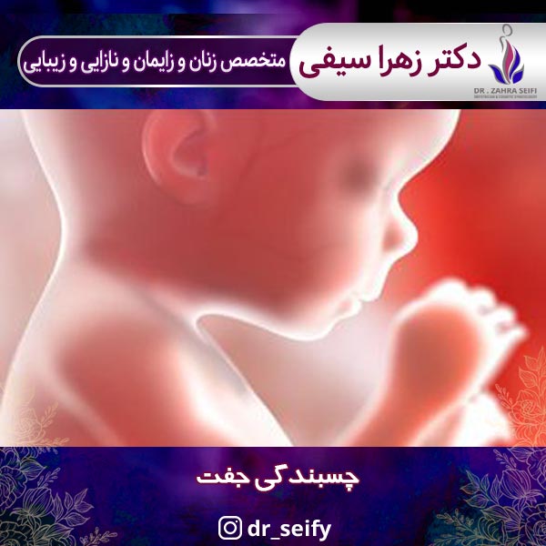 چسبندگی جفت